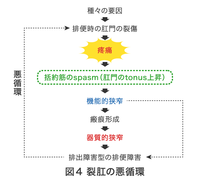 図4 裂肛の悪循環