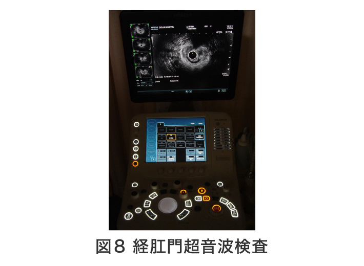 図8 経肛門超音波検査