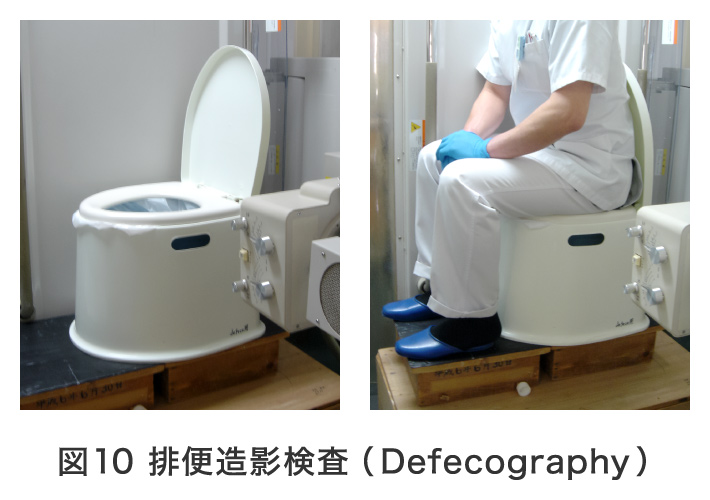 図10 排便造影検査（Defecography）